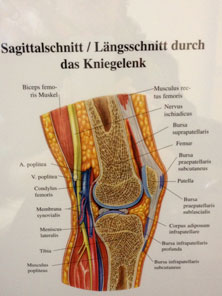 Knie - Schnitt gezeichnet Foto von einer Zeichnung eines Knies ist zu sehen.